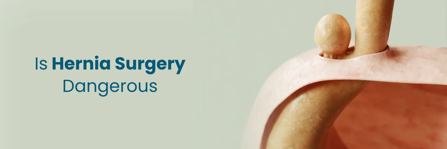 How Much Does Hernia Surgery Auckland Typically Cost? A Complete Guide